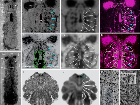 Mollsoniid prosomal nervous system