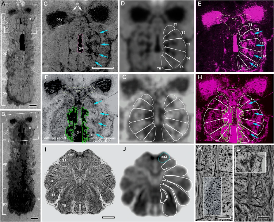 Mollsoniid prosomal nervous system
