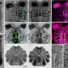Mollsoniid prosomal nervous system
